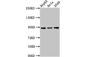 Western Blot Positive WB detected in: HepG2 whole cell lysate, Hela whole cell lysate, A549 whole cell lysate All lanes: CHD1L antibody at 3 μg/mL Secondary Goat polyclonal to rabbit IgG at 1/50000 dilution Predicted band size: 101, 91, 78, 89, 70 kDa Observed band size: 91 kDa (CHD1L antibody  (AA 704-897))