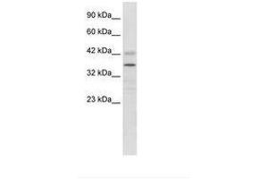 Image no. 2 for anti-Proline Rich 7 (Synaptic) (PRR7) (AA 160-209) antibody (ABIN6735904) (PRR7 antibody  (AA 160-209))