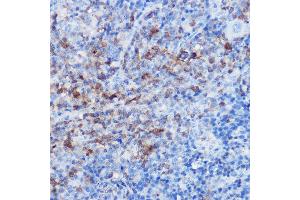 Immunohistochemistry of paraffin-embedded rat spleen using CX3CR1 Rabbit pAb (ABIN3016929, ABIN3016930, ABIN1679440 and ABIN6219885) at dilution of 1:25 (40x lens). (CX3CR1 antibody)