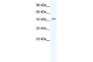 WB Suggested Anti-DMRTB1 Antibody Titration:  5. (DMRTB1 antibody  (Middle Region))