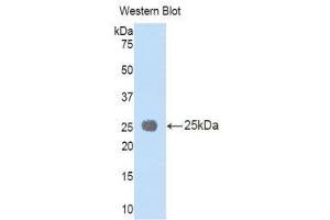 Western Blotting (WB) image for anti-Interleukin 1 Receptor Accessory Protein (IL1RAP) (AA 65-249) antibody (ABIN1176676) (IL1RAP antibody  (AA 65-249))