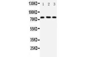 Anti-DDX4/MVH antibody, Western blotting Lane 1: Rat Testis Tissue Lysate Lane 2: Mouse Testis Tissue Lysate Lane 3: HELA Cell Lysate (DDX4 antibody  (Middle Region))