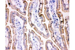 IHC(F) staining of rat intestine tissue (JUP antibody  (AA 556-745))