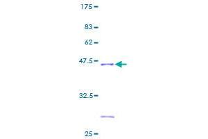 NDUFB6 Protein (AA 1-128) (GST tag)