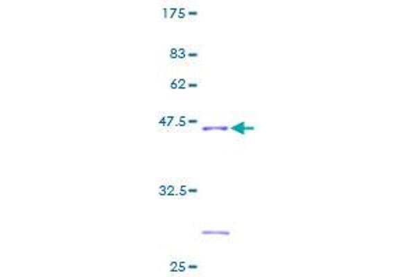 NDUFB6 Protein (AA 1-128) (GST tag)