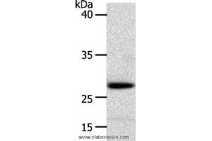 Western blot analysis of Human liver cancer tissue, using RARRES1 Polyclonal Antibody at dilution of 1:300 (RARRES1 antibody)