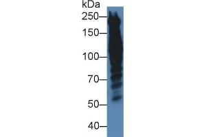 Western Blot; Sample: Human Hela cell lysate; Primary Ab: 5µg/ml Rabbit Anti-Human PPL Antibody Second Ab: 0. (PPL antibody  (AA 1439-1716))