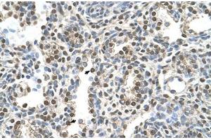 Immunohistochemical staining (Formalin-fixed paraffin-embedded sections) of human lung with MAGEA8 polyclonal antibody . (MAGEA8 antibody  (AA 51-100))