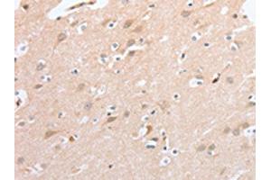The image on the left is immunohistochemistry of paraffin-embedded Human brain tissue using ABIN7131058(SIGLEC9 Antibody) at dilution 1/40, on the right is treated with fusion protein.