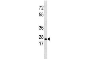 ERAB antibody western blot analysis in 293 lysate (Endoplasmic Reticulum Amyloid Binding Protein (ERAB) (AA 199-235) antibody)