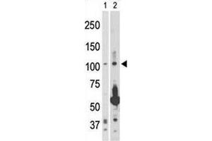 NIK antibody used in western blot to detect NIK in 293 cell lysate (Lane 1) and rat testis tissue lysate (2). (MAP3K14 antibody  (AA 119-148))