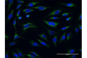 Immunofluorescence of purified MaxPab antibody to ATP5O on HeLa cell.
