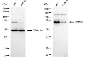 Western blotting analysis using PPM1G antibody (ABIN7800034). (Recombinant PPM1G antibody)