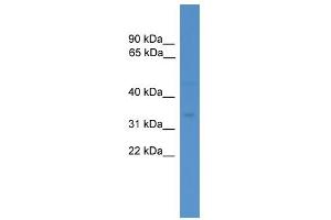 WB Suggested Anti-FAS Antibody Titration: 0. (FAS antibody  (N-Term))