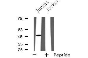 Western blot analysis of extracts from Jurkat cells, using GPR142 antibody. (GPR142 antibody  (Internal Region))