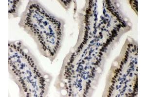 IHC testing of FFPE mouse intestine with CSNK1A1 antibody. (CSNK1A1 antibody)