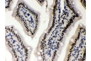 IHC testing of FFPE mouse intestine with CSNK1A1 antibody.
