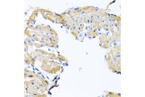 Immunohistochemistry of paraffin-embedded mouse heart using GPLD1 antibody (ABIN5973975) at dilution of 1/100 (40x lens). (GPLD1 antibody)