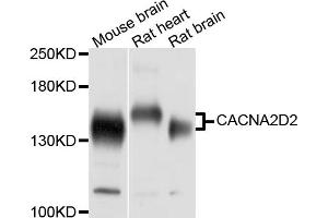 Western blot analysis of extracts of various cell lines, using CACNA2D2 antibody. (CACNA2D2 antibody)