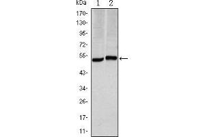 Western blot analysis using CA9 mouse mAb against Hela (1) and A549 (2) cell lysate.