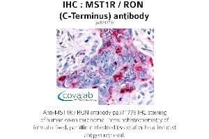 Image no. 1 for anti-Macrophage Stimulating 1 Receptor (C-Met-Related tyrosine Kinase) (MST1R) (C-Term) antibody (ABIN1737095) (MST1R antibody  (C-Term))