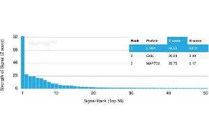 Analysis of Protein Array containing more than 19,000 full-length human proteins using IL3RA / CD123 Rabbit Recombinant Monoclonal Antibody (IL3RA /2947R). (Recombinant IL3RA antibody  (AA 26-171))