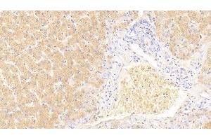 Detection of GDN in Human Liver Tissue using Polyclonal Antibody to Glia Derived Nexin (GDN) (SERPINE2 antibody  (AA 20-398))