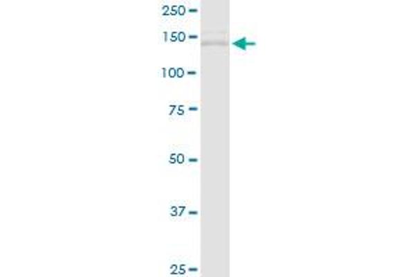 TIMELESS antibody  (AA 1-1208)