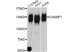 Western blot analysis of extracts of various cell lines, using CHAMP1 Antibody. (ZNF828 antibody  (AA 563-812))