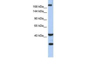 DISP1 antibody used at 1 ug/ml to detect target protein. (DISP1 antibody)