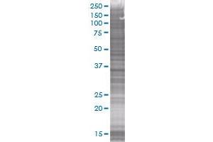 Western Blotting (WB) image for AKR1B1 293T Cell Transient Overexpression Lysate(Denatured) (ABIN1330882)