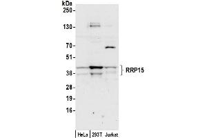 anti-Ribosomal RNA Processing 15 Homolog (RRP15) (AA 75-125) antibody