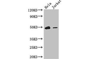 Western Blot Positive WB detected in: Hela whole cell lysate, Jurkat whole cell lysate All lanes: IKZF1 antibody at 3. (IKZF1 antibody  (AA 1-265))