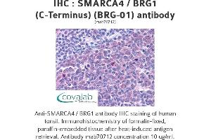 Image no. 3 for anti-SWI/SNF Related, Matrix Associated, Actin Dependent Regulator of Chromatin, Subfamily A, Member 4 (SMARCA4) (C-Term) antibody (ABIN1723569) (SMARCA4 antibody  (C-Term))