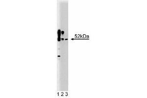 Western blot analysis of CaM Kinase II on a rat cerebrum lysate (First Panel). (CAMK2A antibody  (AA 448-460))