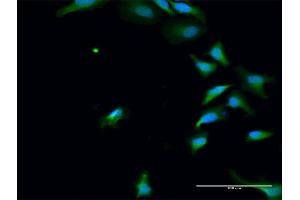 Immunofluorescence of purified MaxPab antibody to PAK6 on HeLa cell. (PAK6 antibody  (AA 1-681))