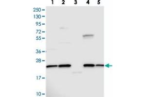 Western blot analysis of Lane 1: RT-4, Lane 2: U-251 MG, Lane 3: Human Plasma, Lane 4: Liver, Lane 5: Tonsil with NPVF polyclonal antibody .