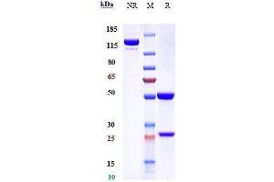Anti-CD14 Reference Antibody (atibuclimab) on SDS-PAGE under reducing (R) condition. (Recombinant CD14 (Atibuclimab Biosimilar) antibody)