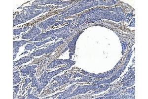 IHC analysis of Filamin A/FLNA using anti-Filamin A/FLNA antibody (ABIN7601783). (Filamin A antibody  (AA 451-638))