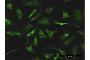 Immunofluorescence (IF) image for anti-Glutaminyl-tRNA Synthetase (QARS) (AA 1-775) antibody (ABIN519576)
