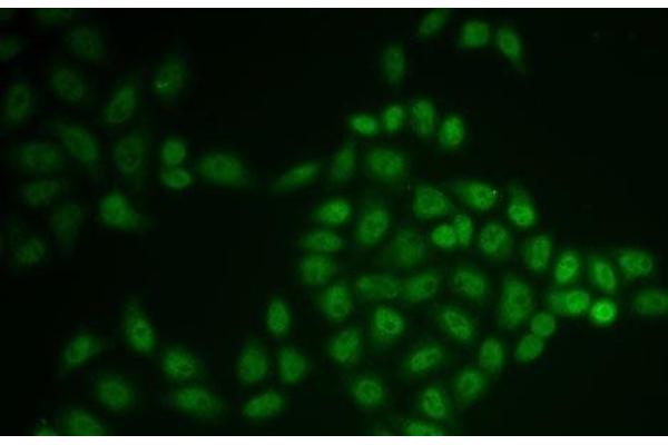 BTG1 antibody