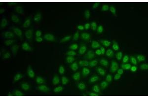Immunofluorescence analysis of U2OS cells using BTG1 Polyclonal Antibody