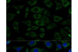 Immunofluorescence analysis of L929 cells using NDUFB7 Polyclonal Antibody at dilution of 1:100 (40x lens). (NDUFB7 antibody)