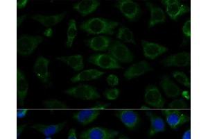 Immunofluorescence analysis of L929 cells using NDUFB7 Polyclonal Antibody at dilution of 1:100 (40x lens). (NDUFB7 antibody)