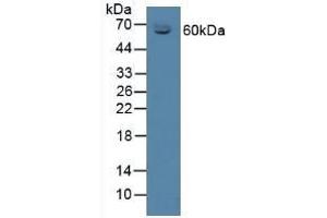 Detection of CBG in Mouse Serum using Polyclonal Antibody to Corticosteroid Binding Globulin (CBG) (SERPINA6 antibody  (AA 268-391))