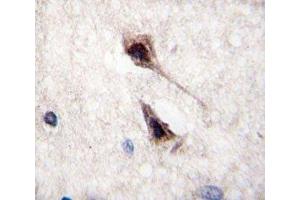 IHC analysis of FFPE human brain tissue stained with MEF2C antibody (MEF2C antibody  (AA 365-394))