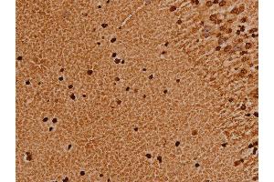 ABIN6276980 at 1/200 staining human brain tissue sections by IHC-P. (TRIM21 antibody  (C-Term))