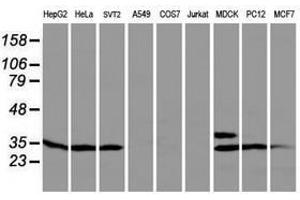 Image no. 1 for anti-Protein tyrosine Phosphatase, Non-Receptor Type 7 (PTPN7) antibody (ABIN1500502) (PTPN7 antibody)