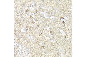 Immunohistochemistry of paraffin-embedded human brain using CX3CL1 Rabbit pAb (ABIN6129035, ABIN6139265, ABIN6139266 and ABIN6218481) at dilution of 1:150 (40x lens). (CX3CL1 antibody  (AA 365-397))