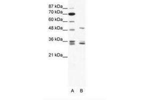 Image no. 1 for anti-Zinc Finger Protein 488 (ZNF488) (C-Term) antibody (ABIN202284) (ZNF488 antibody  (C-Term))
